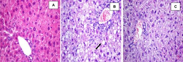 https://cdn.ncbi.nlm.nih.gov/pmc/blobs/bca5/2848040/f22f6de01b5f/1476-511X-9-23-3.jpg