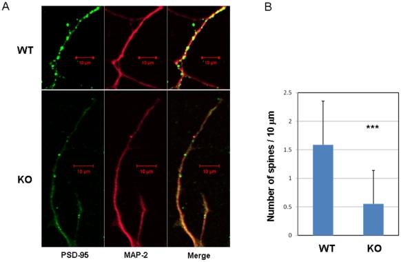 https://cdn.ncbi.nlm.nih.gov/pmc/blobs/bca6/2904696/760f320ad114/pone.0011602.g005.jpg