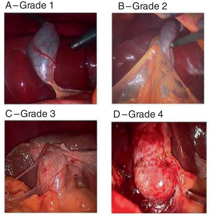 https://cdn.ncbi.nlm.nih.gov/pmc/blobs/bcaa/12105563/63bdde4baca9/ANS-95-926-g001.jpg