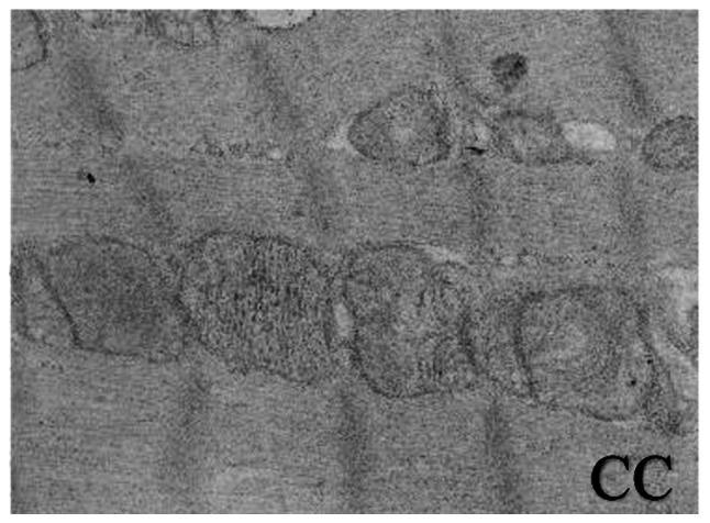https://cdn.ncbi.nlm.nih.gov/pmc/blobs/bcab/7098214/aee5b0e50f41/etm-19-04-2441-g04.jpg