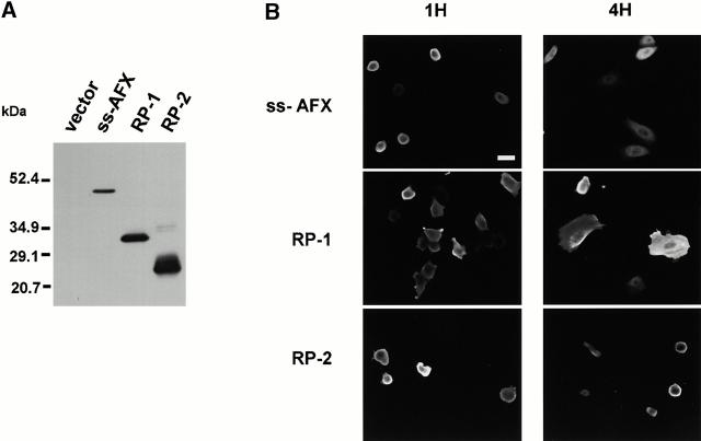 https://cdn.ncbi.nlm.nih.gov/pmc/blobs/bcb2/2192033/de7500cc6db1/JCB0011036.f9ab.jpg