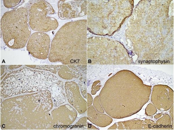 https://cdn.ncbi.nlm.nih.gov/pmc/blobs/bcb4/8796863/0c3a647fa93a/autopsy-12-e2021352-g03.jpg