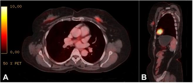 https://cdn.ncbi.nlm.nih.gov/pmc/blobs/bcb4/8796863/c7b872cf9713/autopsy-12-e2021352-g01.jpg