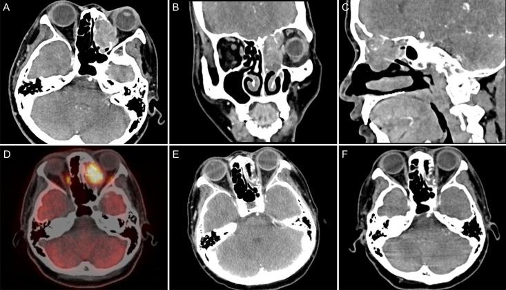 https://cdn.ncbi.nlm.nih.gov/pmc/blobs/bcbe/11659667/0f721a81030c/fonc-14-1368187-g003.jpg