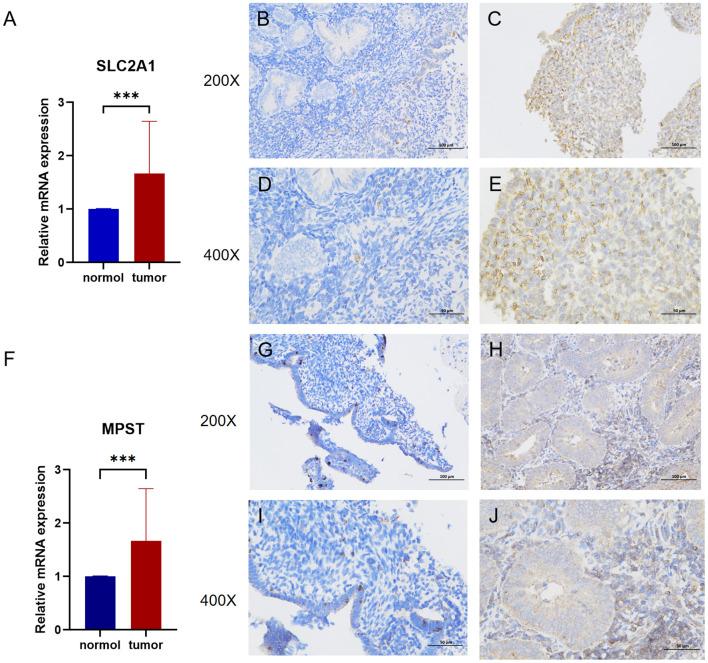 https://cdn.ncbi.nlm.nih.gov/pmc/blobs/bcbf/12310493/ed01a1abff08/fimmu-16-1575916-g003.jpg