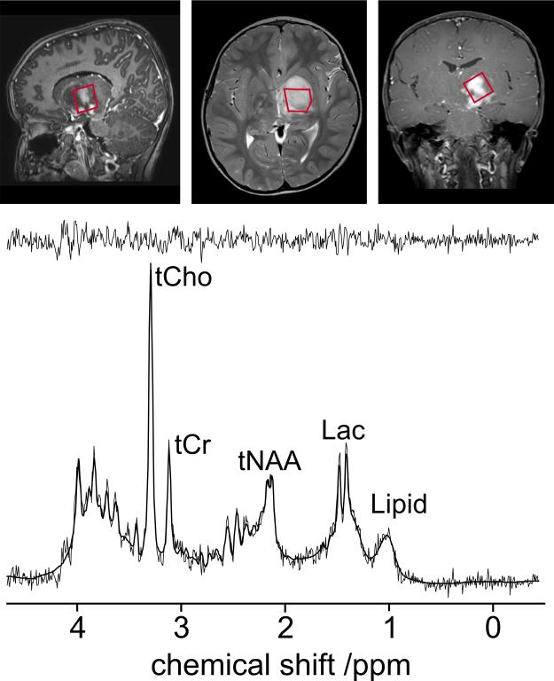 https://cdn.ncbi.nlm.nih.gov/pmc/blobs/bcc0/4029084/de84eb5a1ca6/gr4.jpg