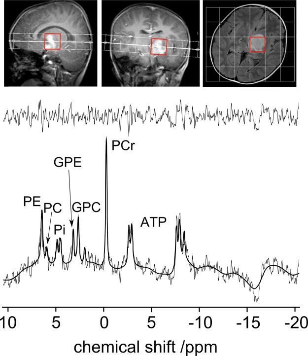 https://cdn.ncbi.nlm.nih.gov/pmc/blobs/bcc0/4029084/ec45213060d0/gr5.jpg