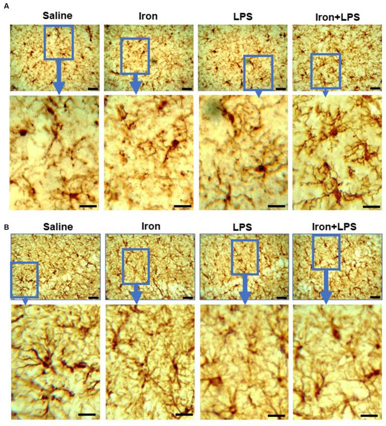 https://cdn.ncbi.nlm.nih.gov/pmc/blobs/bcc1/11148467/0049a08c5d8b/fnagi-16-1393351-g004.jpg