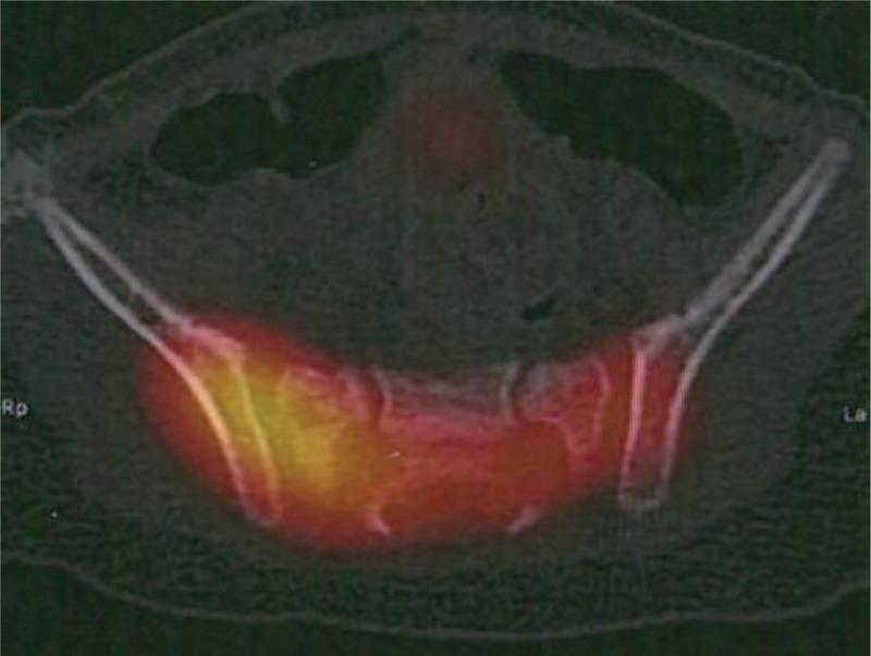 https://cdn.ncbi.nlm.nih.gov/pmc/blobs/bcc3/4620820/6aef9ea8583d/medi-94-e1581-g002.jpg
