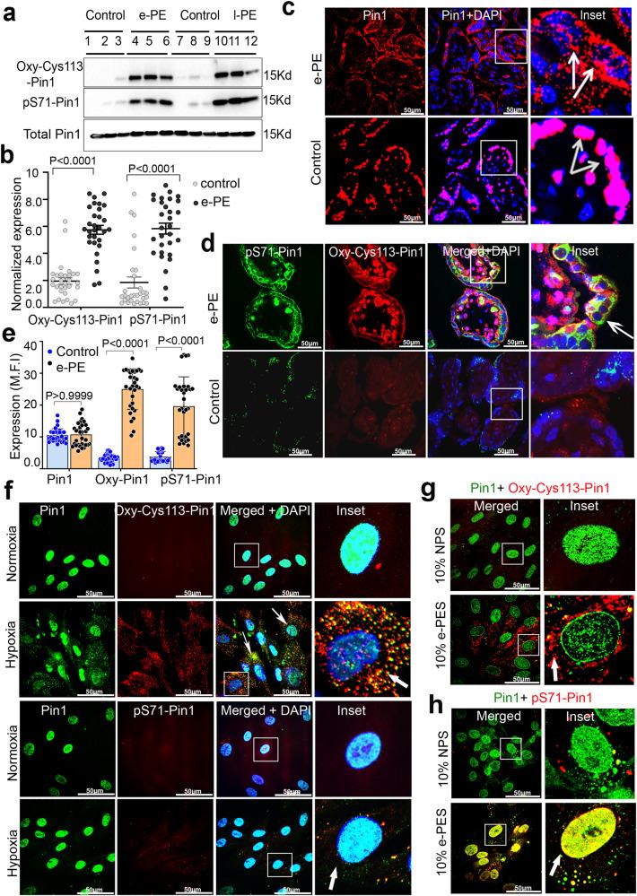 https://cdn.ncbi.nlm.nih.gov/pmc/blobs/bcc4/10480164/7f1475c8c581/41467_2023_41144_Fig2_HTML.jpg