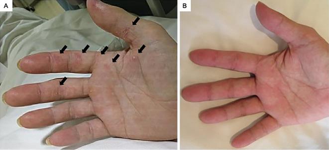 https://cdn.ncbi.nlm.nih.gov/pmc/blobs/bcc6/11473280/27b687c3c9d2/1349-7235-63-2571-g001.jpg