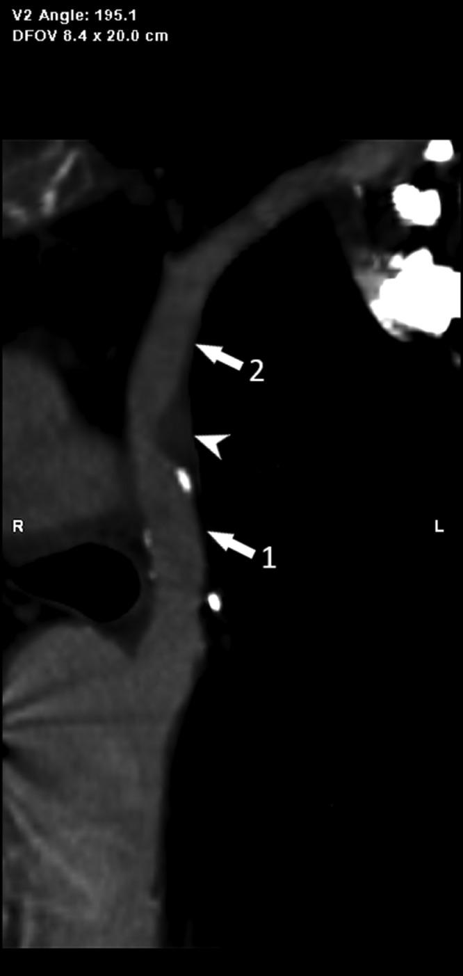 https://cdn.ncbi.nlm.nih.gov/pmc/blobs/bcc8/9829553/b38bdafd65c1/gr2.jpg