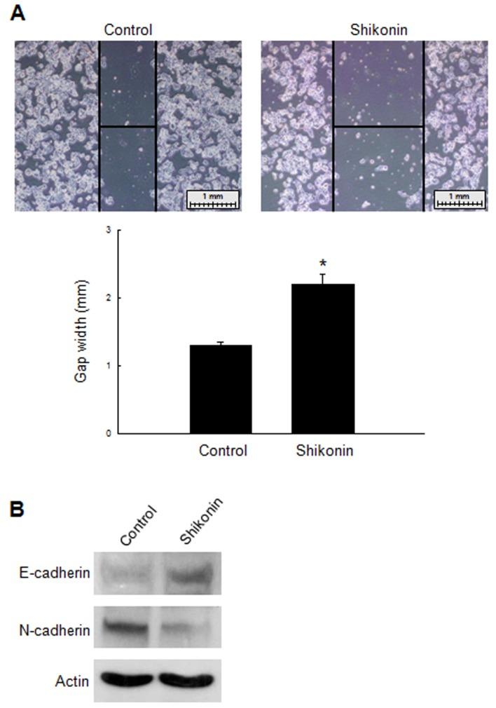 https://cdn.ncbi.nlm.nih.gov/pmc/blobs/bcd1/5858079/9c873aa91b77/ol-15-04-5417-g03.jpg