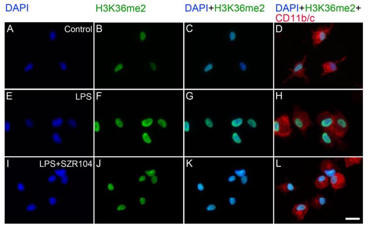 https://cdn.ncbi.nlm.nih.gov/pmc/blobs/bcde/8835130/98b2e2382d47/ijms-23-01079-g013.jpg