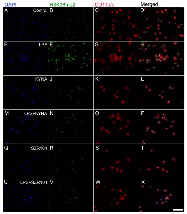 https://cdn.ncbi.nlm.nih.gov/pmc/blobs/bcde/8835130/d47ce81fa723/ijms-23-01079-g012.jpg