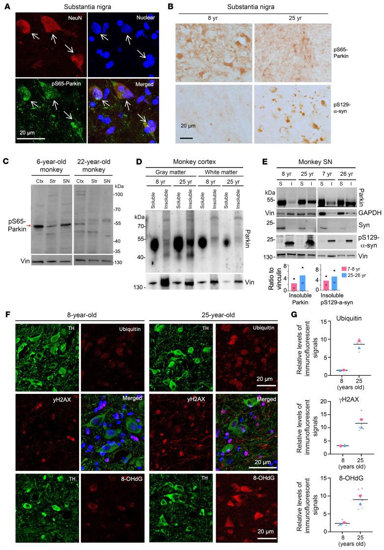 https://cdn.ncbi.nlm.nih.gov/pmc/blobs/bcea/11473153/82b39990e5f1/jci-134-179633-g073.jpg