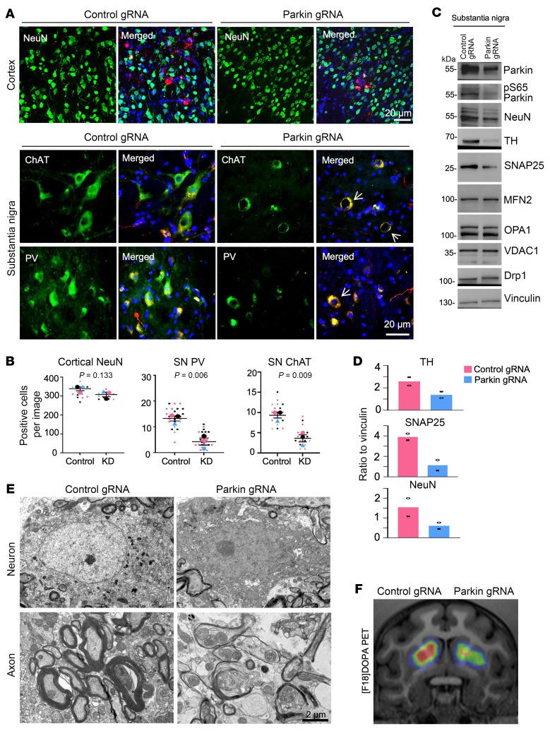https://cdn.ncbi.nlm.nih.gov/pmc/blobs/bcea/11473153/b14910024cf3/jci-134-179633-g071.jpg