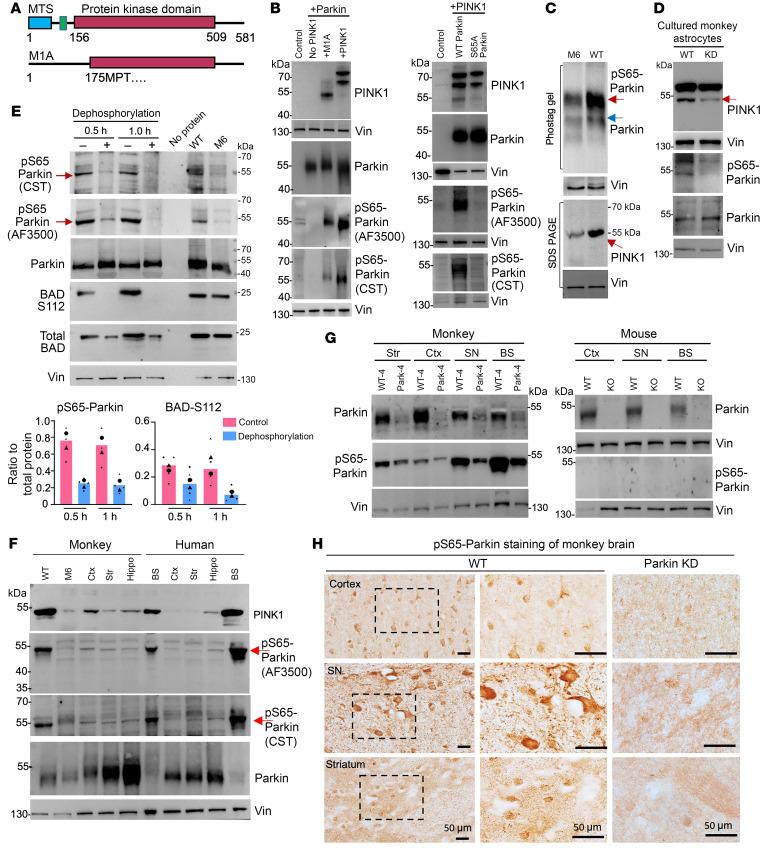 https://cdn.ncbi.nlm.nih.gov/pmc/blobs/bcea/11473153/d0e7ffc2b446/jci-134-179633-g072.jpg