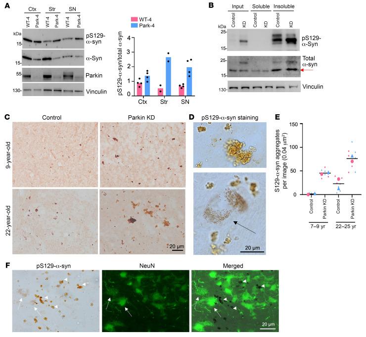 https://cdn.ncbi.nlm.nih.gov/pmc/blobs/bcea/11473153/e96f3e098fd3/jci-134-179633-g074.jpg