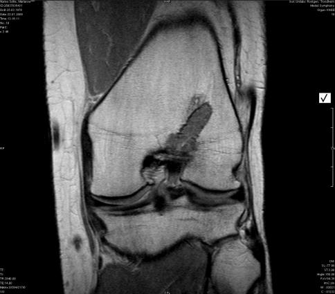 https://cdn.ncbi.nlm.nih.gov/pmc/blobs/bcea/3076560/9d7bb9dec3fd/167_2010_1353_Fig5_HTML.jpg