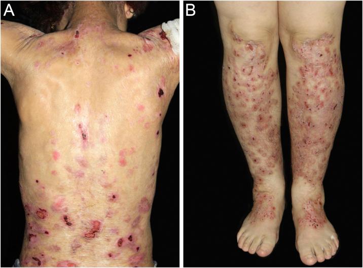 https://cdn.ncbi.nlm.nih.gov/pmc/blobs/bcfe/11074615/1898d481773b/gr1.jpg