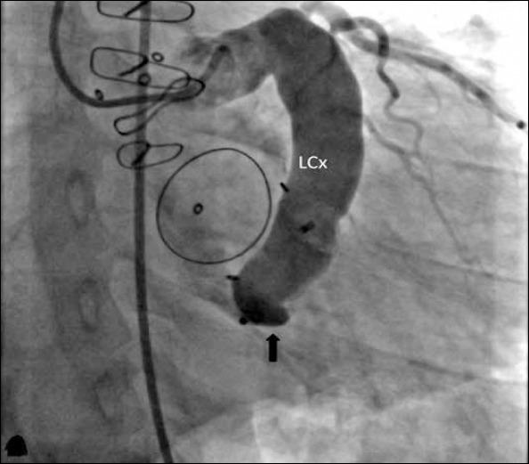 https://cdn.ncbi.nlm.nih.gov/pmc/blobs/bd0b/5779159/6c0353b89545/AJC-15-E17-g004.jpg