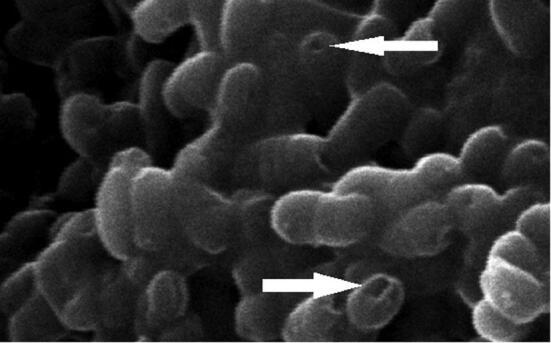 https://cdn.ncbi.nlm.nih.gov/pmc/blobs/bd13/7584810/919971ad04c9/gr1.jpg