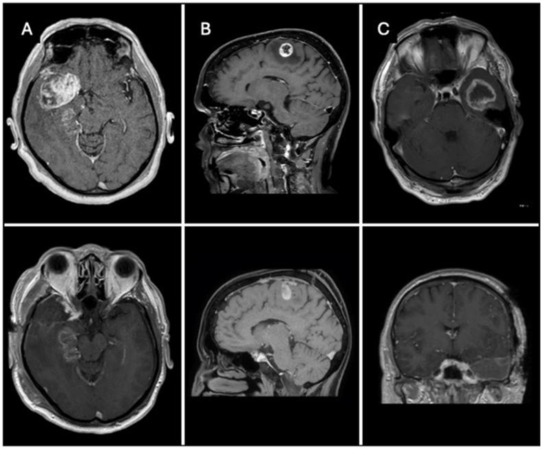 https://cdn.ncbi.nlm.nih.gov/pmc/blobs/bd28/12150109/7ef4add6adf2/gr1.jpg