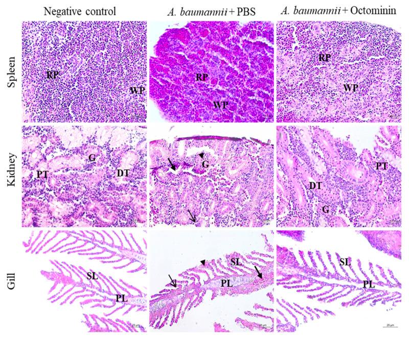 https://cdn.ncbi.nlm.nih.gov/pmc/blobs/bd2a/8161146/87c58c58c600/ijms-22-05353-g009.jpg