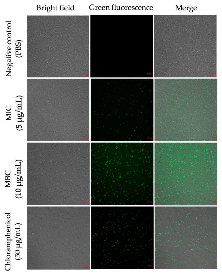 https://cdn.ncbi.nlm.nih.gov/pmc/blobs/bd2a/8161146/ccff2e1cc037/ijms-22-05353-g004.jpg