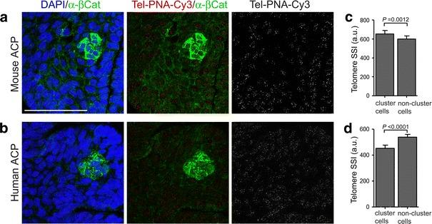 https://cdn.ncbi.nlm.nih.gov/pmc/blobs/bd31/3400760/e2023ac5c15f/401_2012_957_Fig3_HTML.jpg