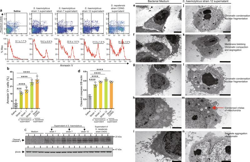 https://cdn.ncbi.nlm.nih.gov/pmc/blobs/bd3a/8943153/80e6d55eb068/41467_2022_29064_Fig1_HTML.jpg