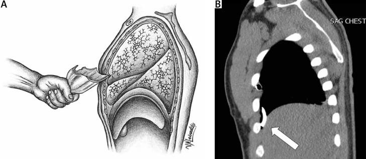 https://cdn.ncbi.nlm.nih.gov/pmc/blobs/bd3b/11523479/d1dc3a0e12eb/KITP-21-54865-g001.jpg