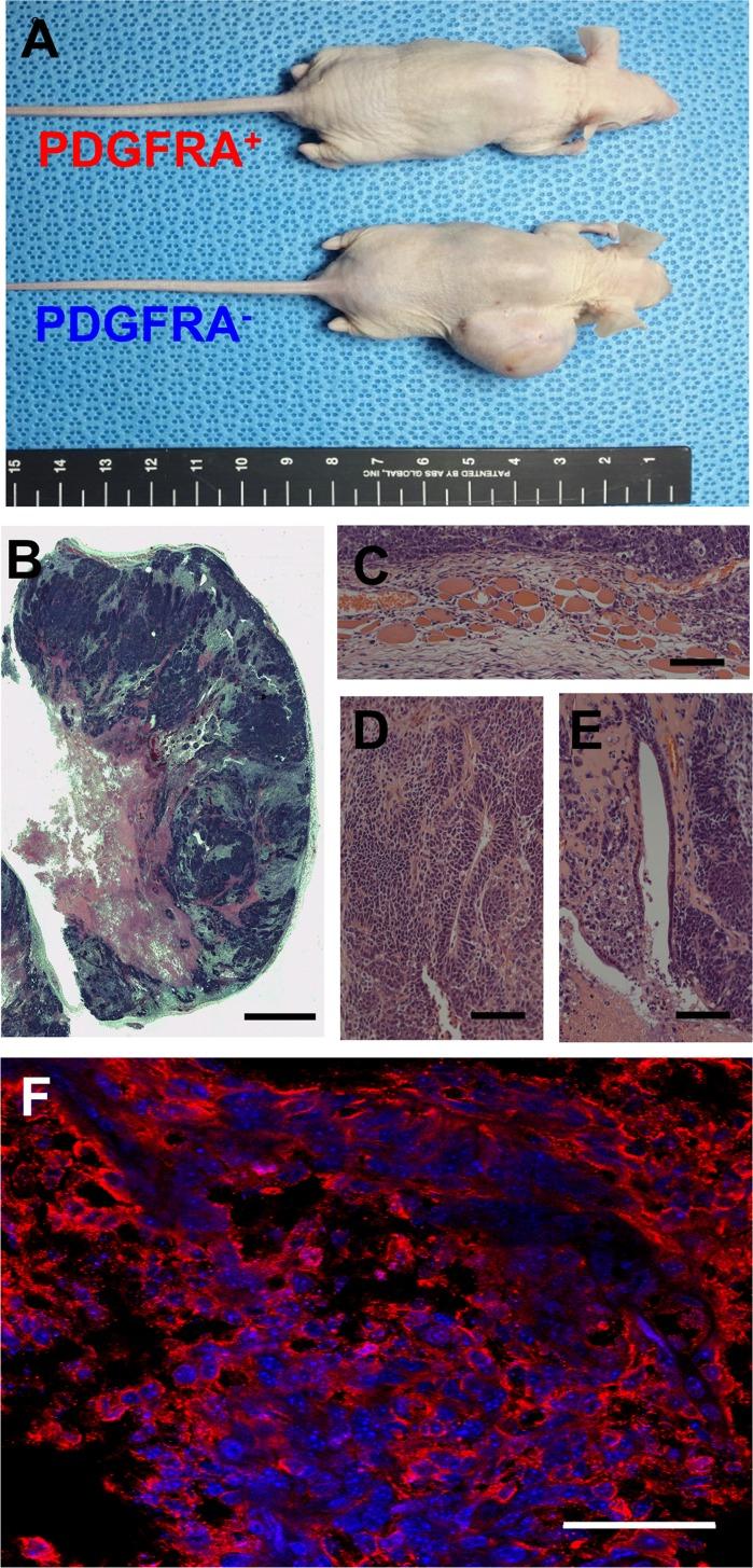 https://cdn.ncbi.nlm.nih.gov/pmc/blobs/bd3c/5444692/fa7a232697c1/oncotarget-08-29643-g002.jpg