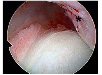 https://cdn.ncbi.nlm.nih.gov/pmc/blobs/bd44/5611901/966ffb5b38b8/TOORTHJ-11-919_F7.jpg
