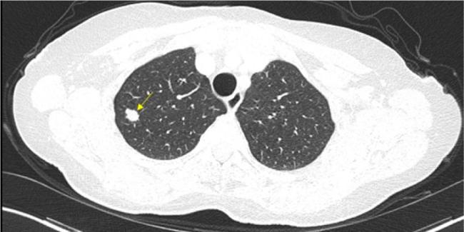 https://cdn.ncbi.nlm.nih.gov/pmc/blobs/bd5a/12061210/2556d6cbba52/5203_Fig2.jpg