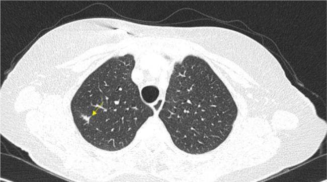https://cdn.ncbi.nlm.nih.gov/pmc/blobs/bd5a/12061210/5921d5eeddd7/5203_Fig3.jpg
