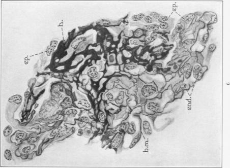 https://cdn.ncbi.nlm.nih.gov/pmc/blobs/bd5b/2062701/7c353e5163c7/amjpathol00725-0030-c.jpg
