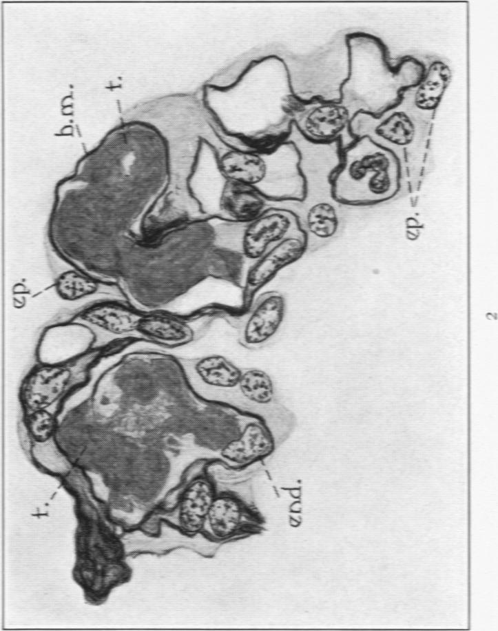 https://cdn.ncbi.nlm.nih.gov/pmc/blobs/bd5b/2062701/c0f471b17b21/amjpathol00725-0028-b.jpg