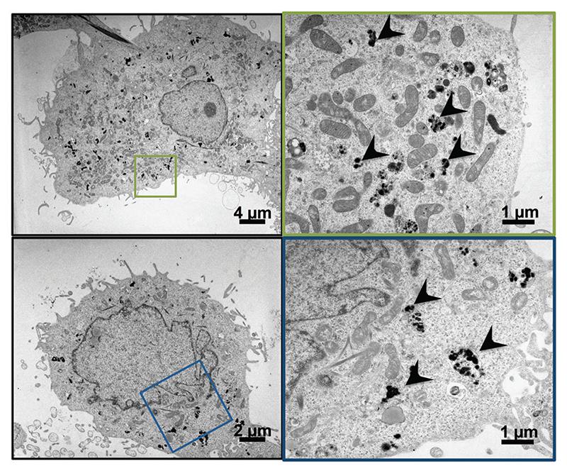 https://cdn.ncbi.nlm.nih.gov/pmc/blobs/bd62/7613424/1a429295abd1/EMS151323-f001.jpg