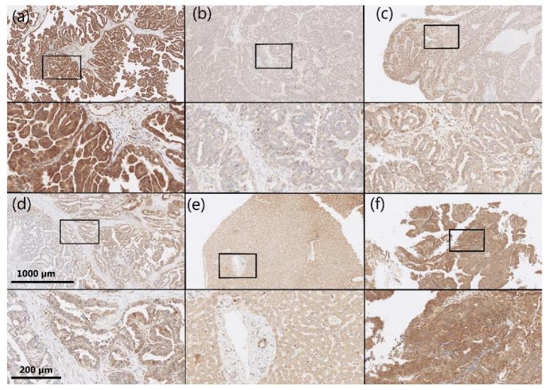 https://cdn.ncbi.nlm.nih.gov/pmc/blobs/bd66/8834204/9b1fd6de9b13/cancers-14-00809-g004.jpg