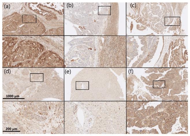 https://cdn.ncbi.nlm.nih.gov/pmc/blobs/bd66/8834204/e9265718d577/cancers-14-00809-g002.jpg
