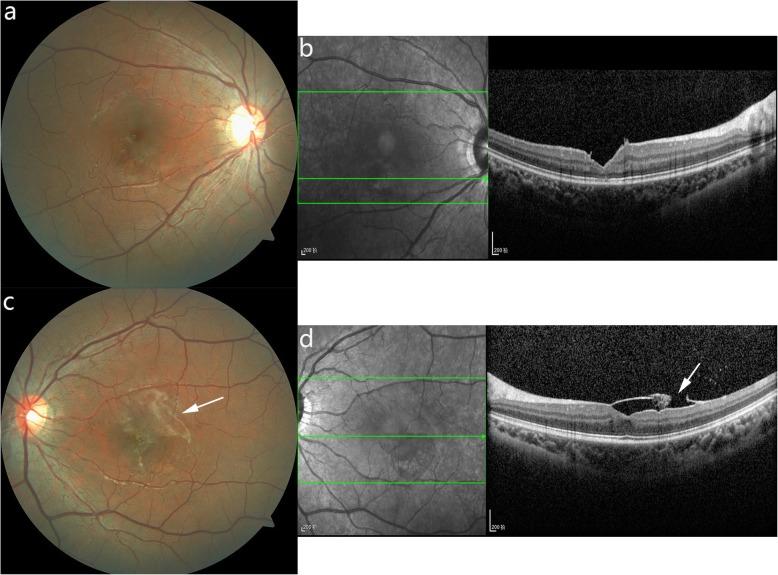 https://cdn.ncbi.nlm.nih.gov/pmc/blobs/bd6b/7161018/b5236c0264cd/12886_2020_1413_Fig3_HTML.jpg