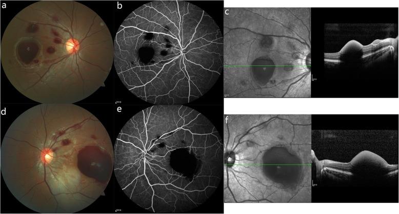 https://cdn.ncbi.nlm.nih.gov/pmc/blobs/bd6b/7161018/d0cb76d50a0c/12886_2020_1413_Fig1_HTML.jpg