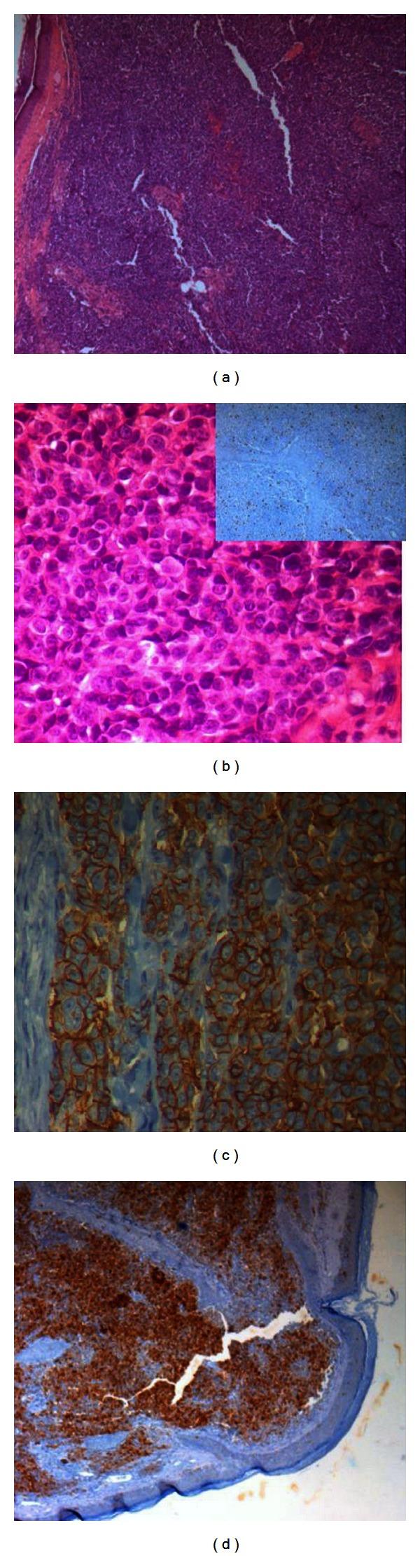 https://cdn.ncbi.nlm.nih.gov/pmc/blobs/bd72/3674650/e420c9be4d64/CRIM.MEDICINE2013-512416.002.jpg