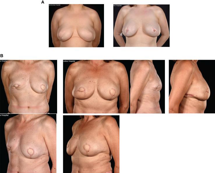 https://cdn.ncbi.nlm.nih.gov/pmc/blobs/bd77/10338173/1855cead103e/fonc-13-1176915-g007.jpg