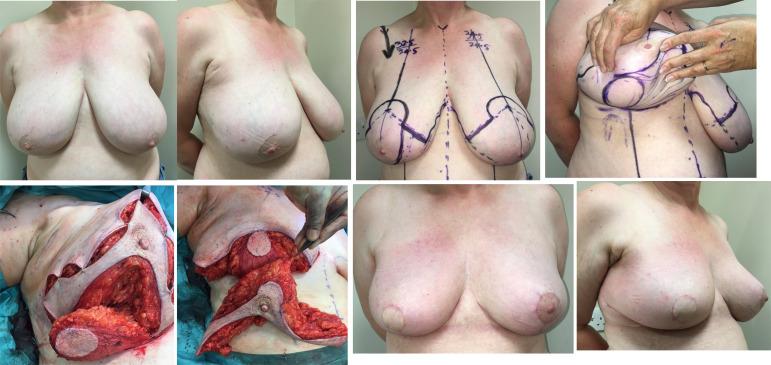 https://cdn.ncbi.nlm.nih.gov/pmc/blobs/bd77/10338173/b7dcf996e149/fonc-13-1176915-g002.jpg