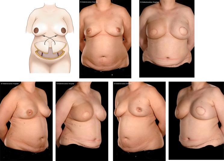 https://cdn.ncbi.nlm.nih.gov/pmc/blobs/bd77/10338173/fc0a0c200626/fonc-13-1176915-g013.jpg