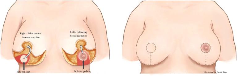 https://cdn.ncbi.nlm.nih.gov/pmc/blobs/bd77/10338173/fd1bc67d59be/fonc-13-1176915-g003.jpg