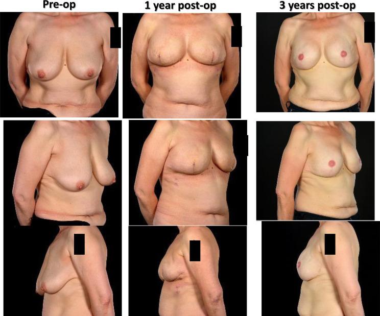 https://cdn.ncbi.nlm.nih.gov/pmc/blobs/bd77/10338173/ff858a742643/fonc-13-1176915-g012.jpg